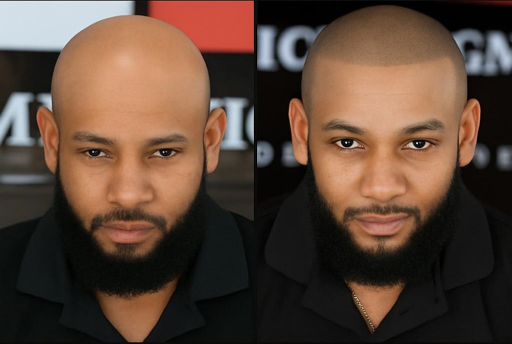 Before and After 1