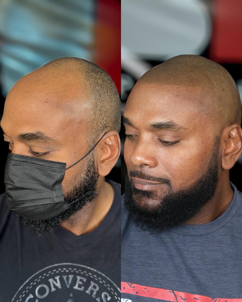 Before and After 4