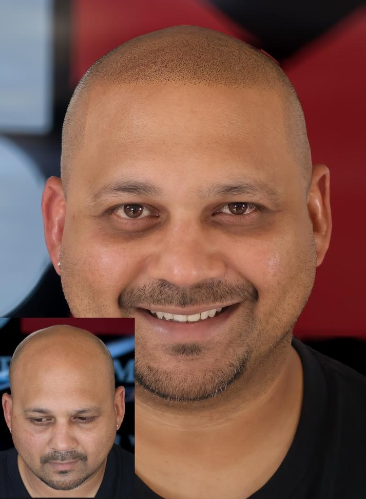 Before and After 3